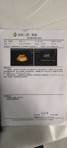 journal_insert_pic_1678024656