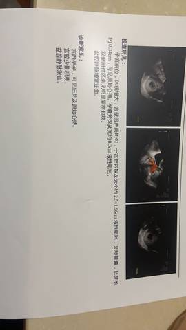 journal_insert_pic_1687816171