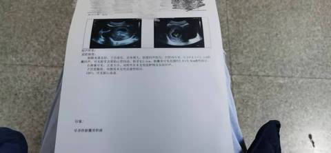 journal_insert_pic_1689385007