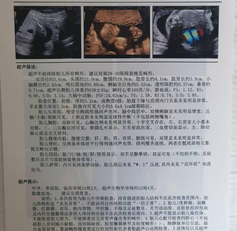 journal_insert_pic_1676148518