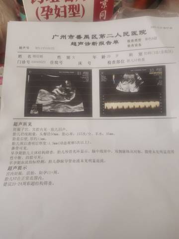 journal_insert_pic_1689430461