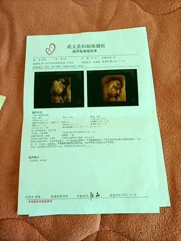 journal_insert_pic_1685949218
