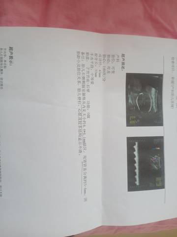 journal_insert_pic_1683534039