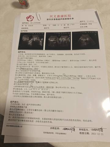 journal_insert_pic_1684306210
