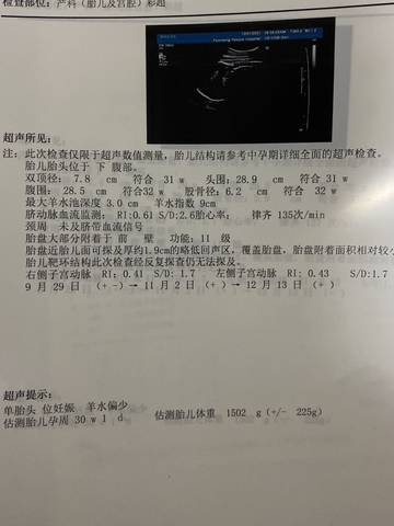 journal_insert_pic_1689673081