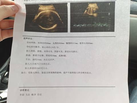 journal_insert_pic_1677271286