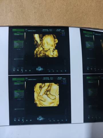 journal_insert_pic_1681084324