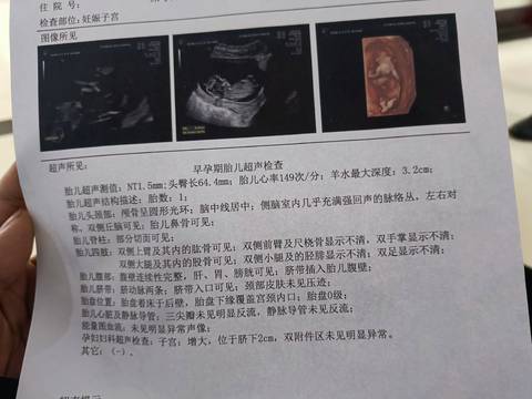 journal_insert_pic_1683590501