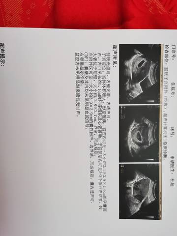 journal_insert_pic_1683576860