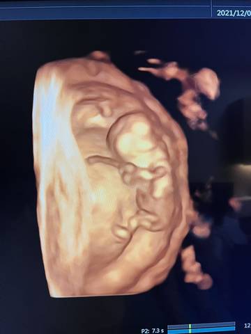 journal_insert_pic_1685604015