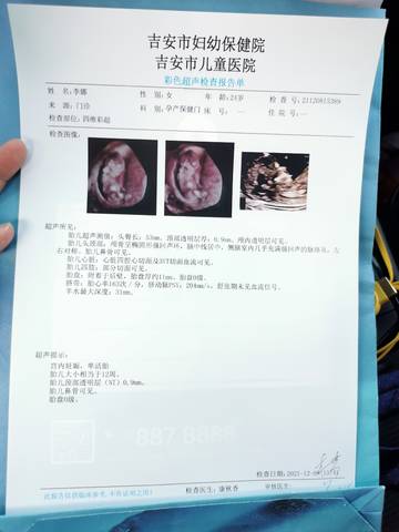 journal_insert_pic_1676633974