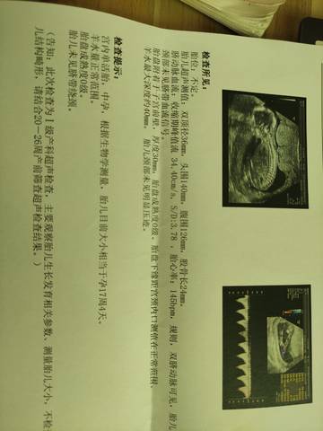 journal_insert_pic_1675971944