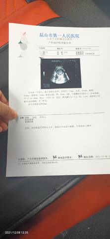 journal_insert_pic_1676679748