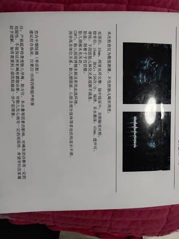 journal_insert_pic_1678133788