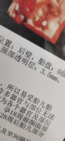journal_insert_pic_1689139584