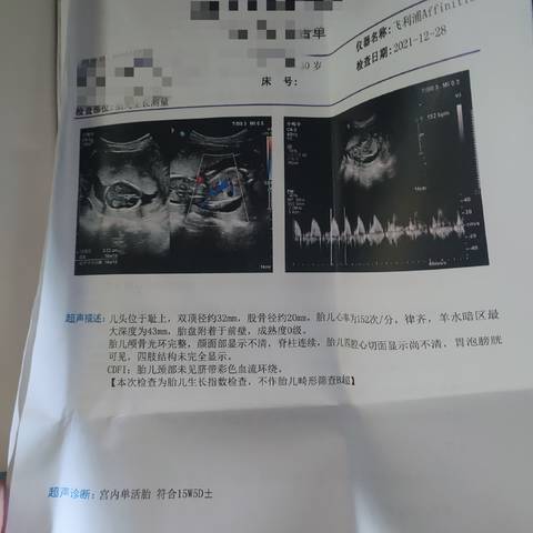 journal_insert_pic_1689012455