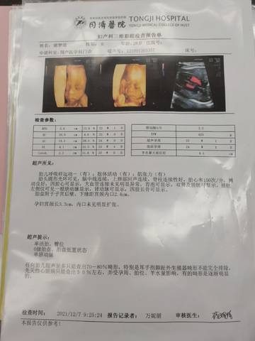 journal_insert_pic_1675864845