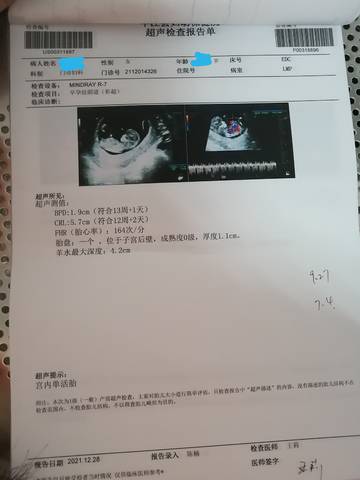 journal_insert_pic_1690026090