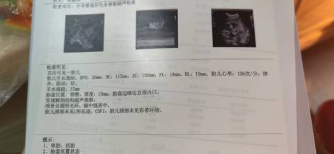 journal_insert_pic_1687875585