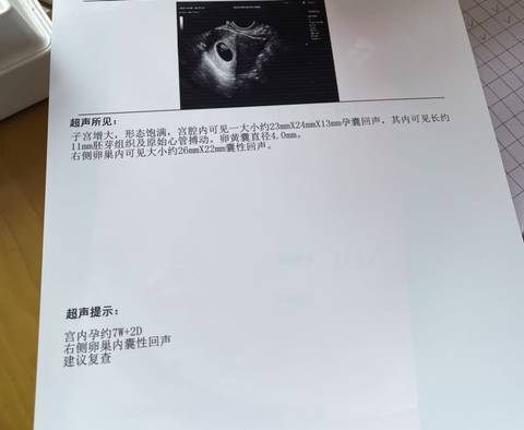 journal_insert_pic_1676955463