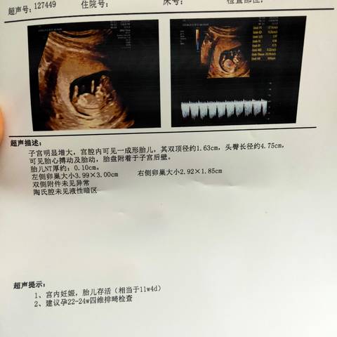 journal_insert_pic_1682126346