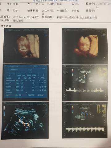 journal_insert_pic_1681118413