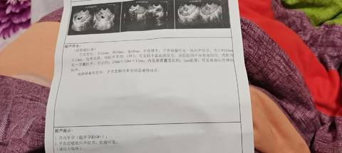 journal_insert_pic_1681707708