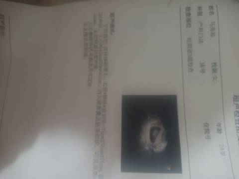 journal_insert_pic_1679389758