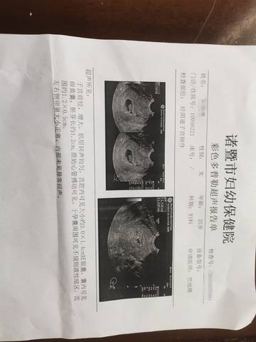 journal_insert_pic_1680973368