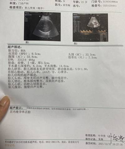 journal_insert_pic_1690172171
