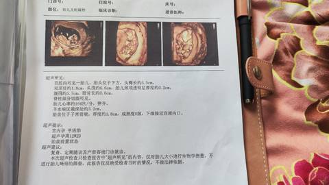 journal_insert_pic_1741079428