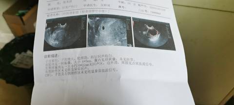 journal_insert_pic_1690355286