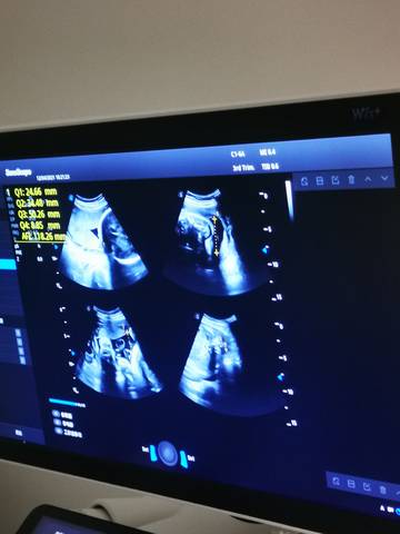 journal_insert_pic_1673521038