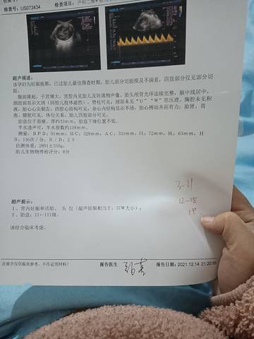 journal_insert_pic_1681677969