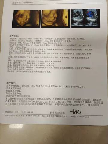 journal_insert_pic_1684352605
