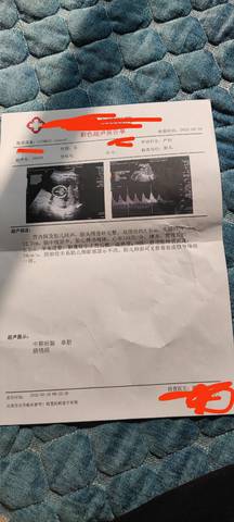 journal_insert_pic_1719485465