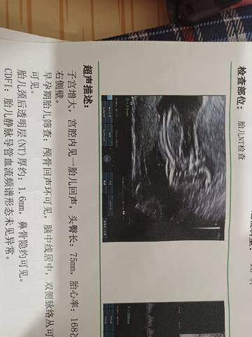 journal_insert_pic_1674316159