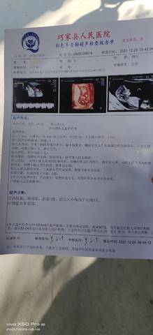 journal_insert_pic_1688224526
