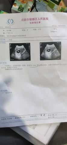 journal_insert_pic_1686496946