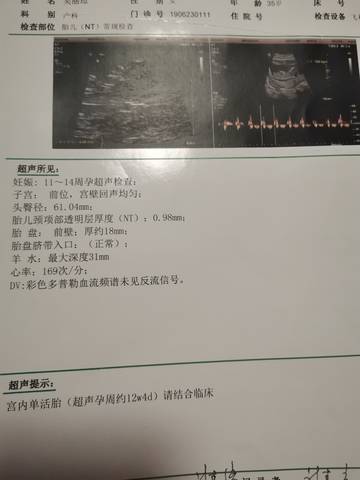 journal_insert_pic_1687320739