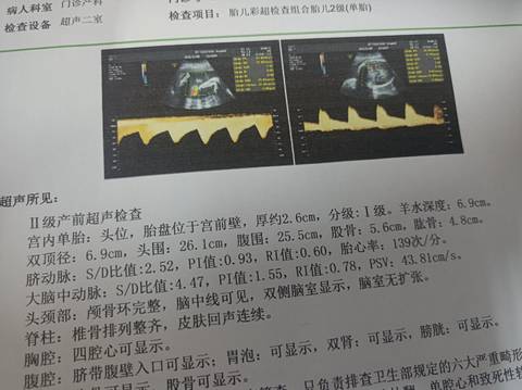 journal_insert_pic_1688872218