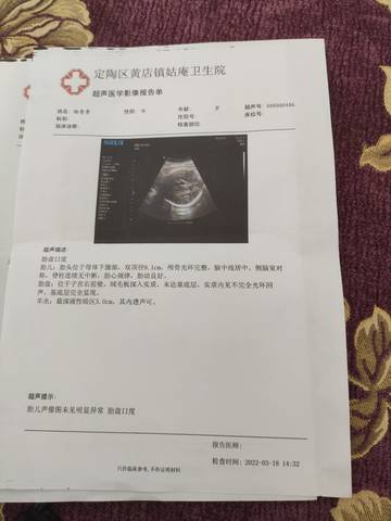 journal_insert_pic_1740855763