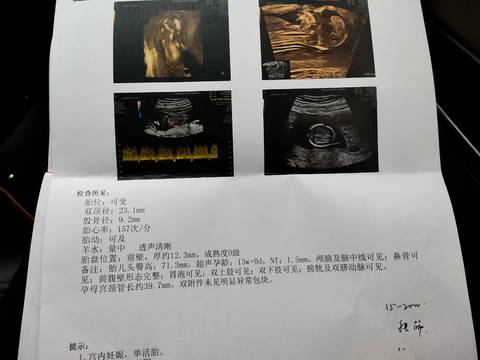 journal_insert_pic_1688125919