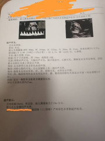 journal_insert_pic_1685907717