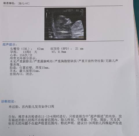 journal_insert_pic_1687852033