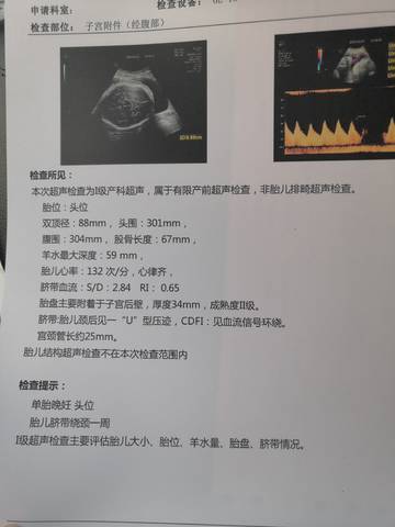 journal_insert_pic_1684250344