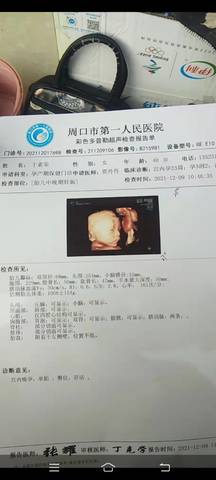 journal_insert_pic_1676820561