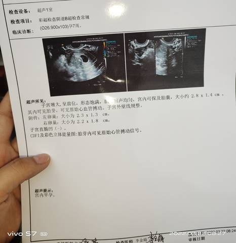 journal_insert_pic_1741071939
