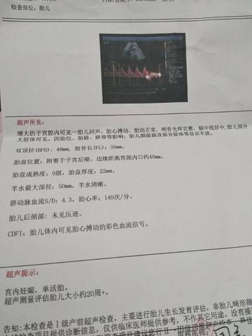 journal_insert_pic_1674460840