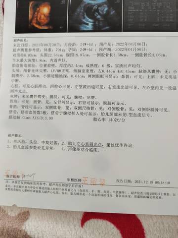 journal_insert_pic_1682498446